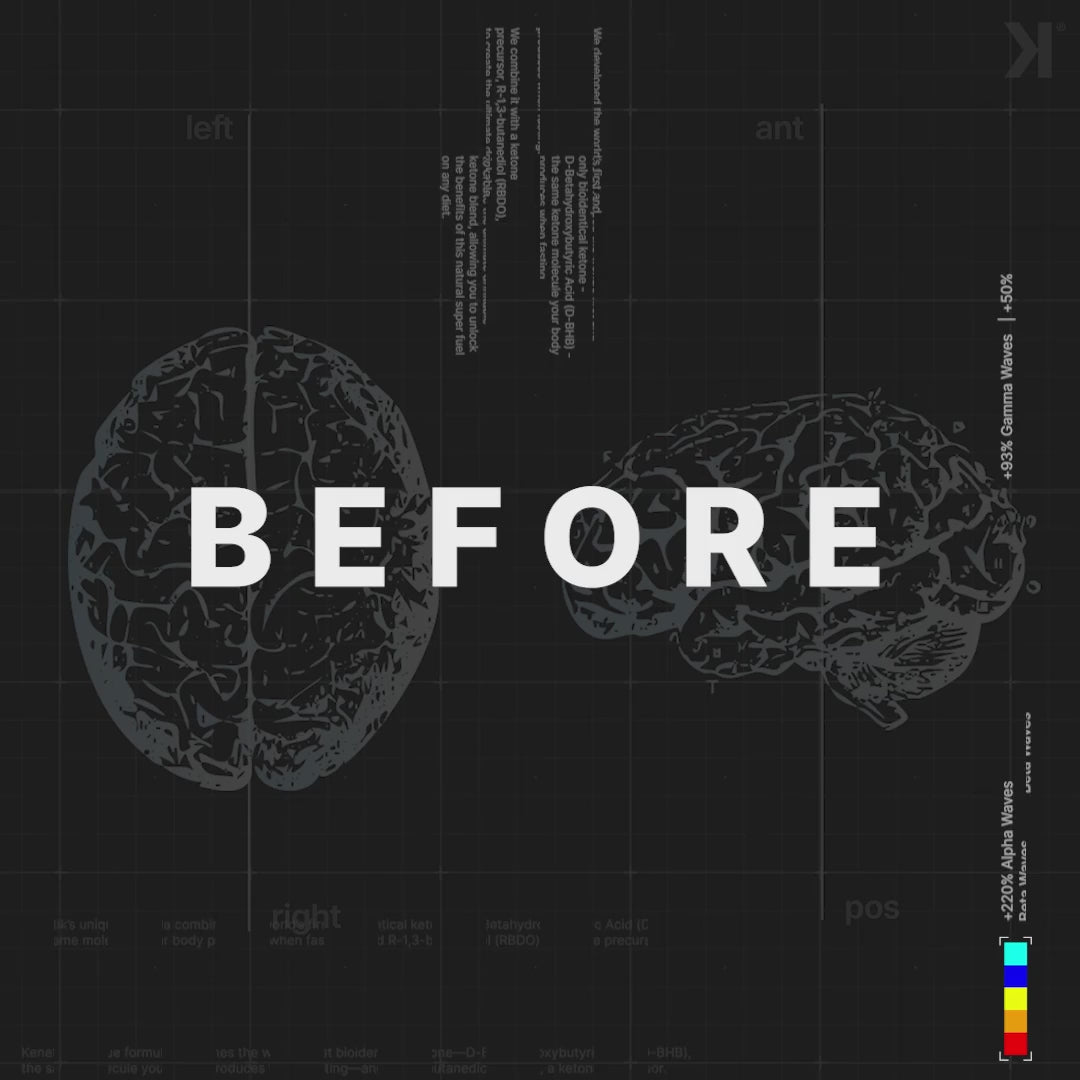 Brain scan with colored markers indicating different brain wave frequencies on a grid background.

The scan shows the increase in brain activity after drinking a serving of Kenetik